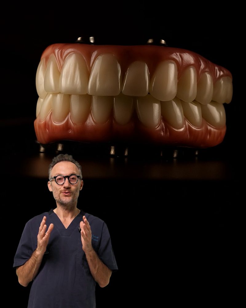 Il Dr. Gaddoni spiega i denti fissi su impianti